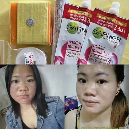 Whitening and spot-removing suit nam tui-Taobao