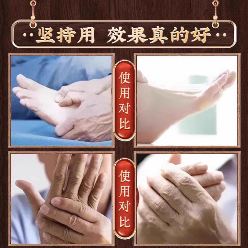 手麻木酸胳膊腿麻？试试这神奇的中药贴，颈椎压迫神经不再怕！-手部-淘宝好物网