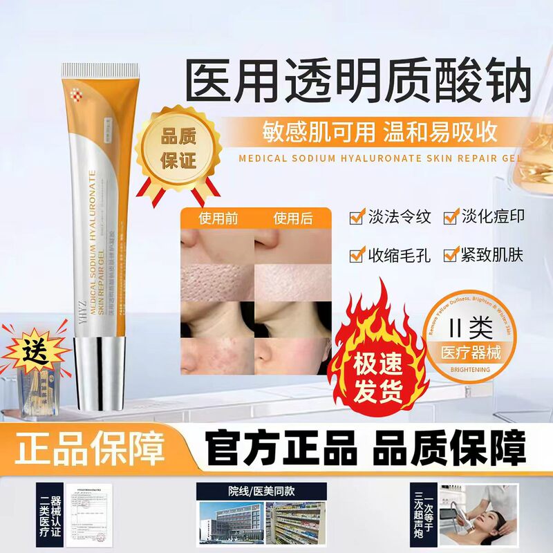 Yhyz Small Orange Tube Vkoo Gel Sodium Hyaluronate Repair Gel for Nasolabial Folds, Pores, and Acne Marks, Gentle Repair Yhyz Small Orange Tube Vkoo Gel Sodium Hyaluronate Repair Gel for Nasolabial Folds, Pores, and Acne Marks, Gentle Repair