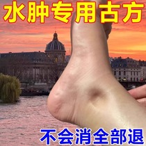 (150% elimination of edema) diuretic drainage and edema removal patch for the elderly with edema in lower limbs swollen feet swollen face and whole body