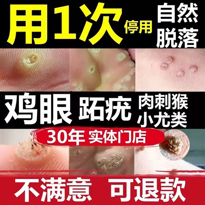 Cumulative help of 100 thousand people-a strain of no worries-DS-Taobao