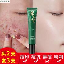 pS herbal plant extract acne removal cream for men and women remove acne fade acne marks acne scars acne scar repair cream students and teenagers