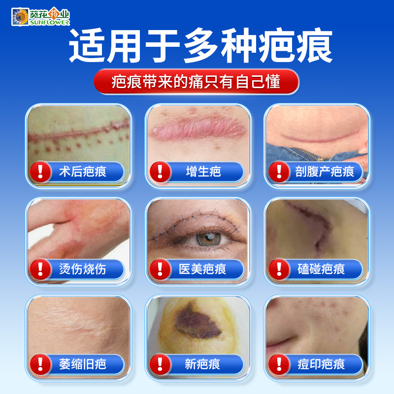二次剖腹产手术一般需要多长时间？教科书般的解答，让准妈妈们放心！