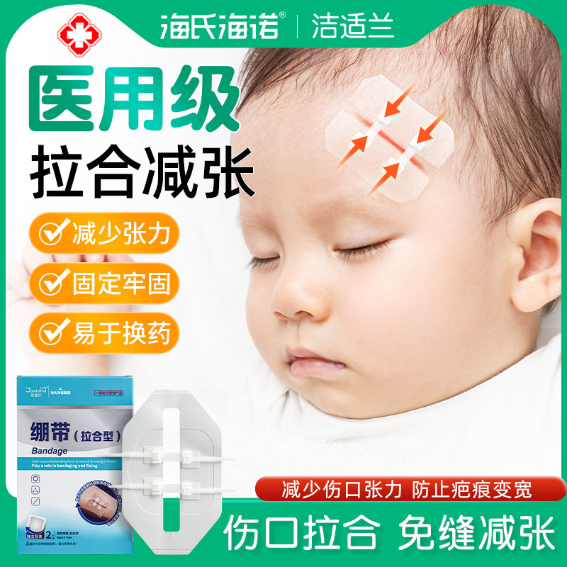 海氏海诺减张贴减张器疤痕皮肤创可贴术后剖腹产拉链式合儿童医用