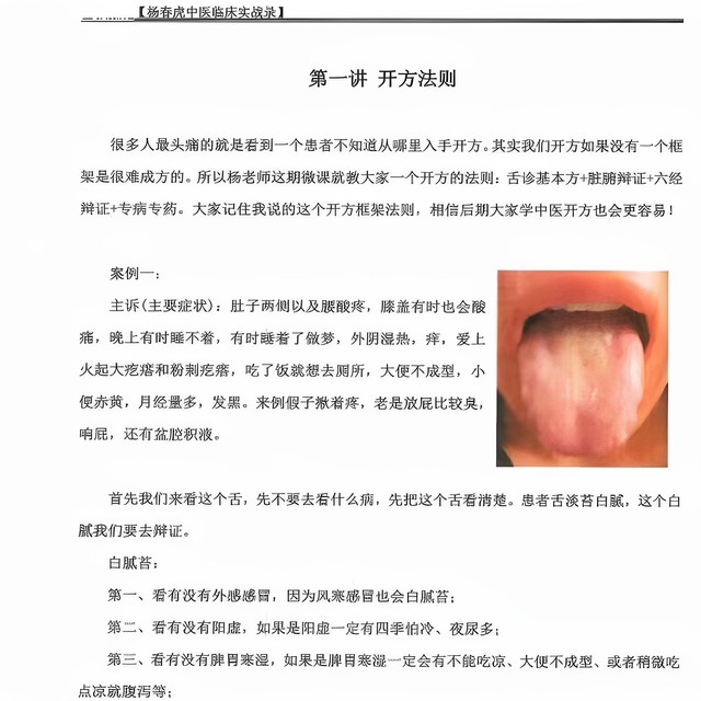 Yang Chunhu's Clinical Practical Records of Traditional Chinese Medicine [Color Print] - Basic Knowledge for Identifying Diseases and Tongue Diagnosis in Shanghan Syndrome