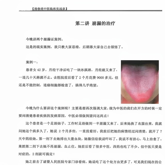 Yang Chunhu's Clinical Practical Records of Traditional Chinese Medicine [Color Print] - Basic Knowledge for Identifying Diseases and Tongue Diagnosis in Shanghan Syndrome