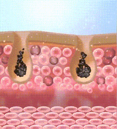 DM_20240715115741_007.gif