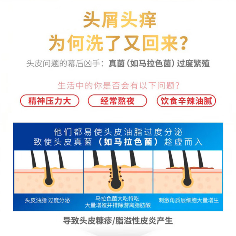 告别头皮困扰，采乐酮康唑洗剂带你重获清爽🍃 -头发护理-淘宝好物网