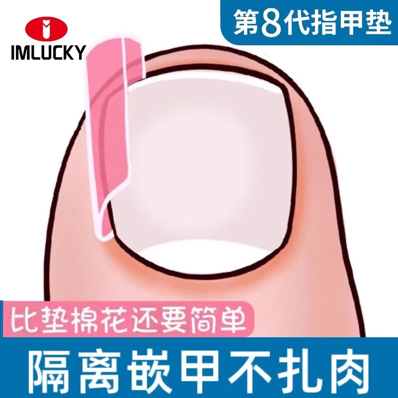 指甲矫正器脚趾甲沟隔离填充垫片防止指甲往肉里长嵌甲专用神器炎