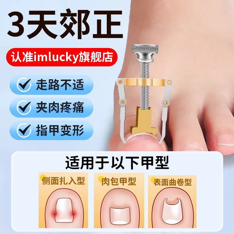 Special Corrector for Ingrown Toenails, Correction Tool for Ingrown Toenails, Specialized Tool for Correcting Ingrown Toenails