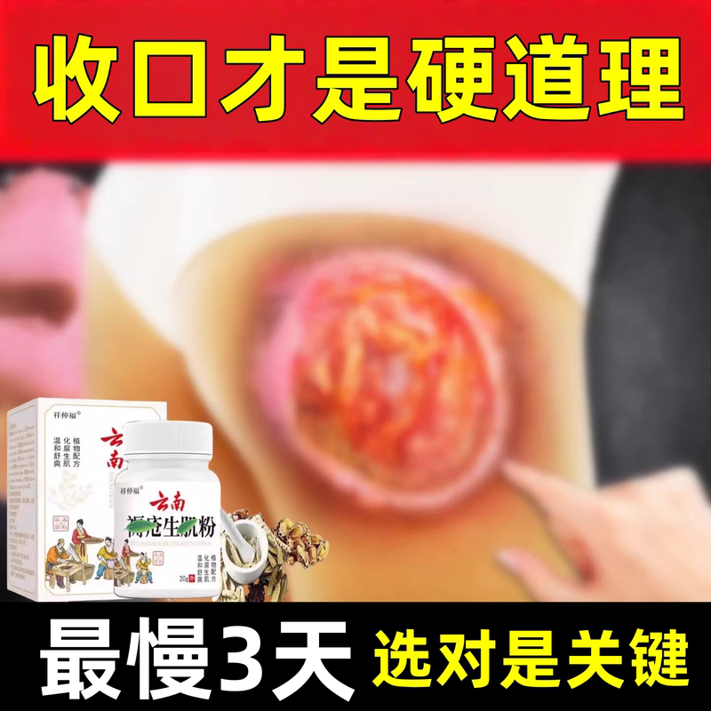 Yunnan Shengji Baiyao Powder for Bedsores, Rapid Healing, Promotes Skin Regeneration, External Use for Elderly People with Buttock Ulcers Yunnan Shengji Baiyao Powder for Bedsores, Rapid Healing, Promotes Skin Regeneration, External Use for Elderly People with Buttock Ulcers