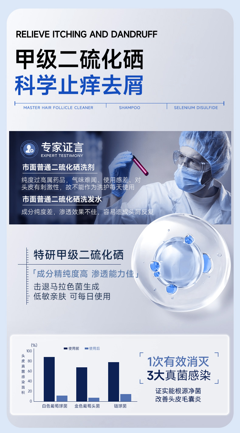 【中国直邮】  逆龄 二硫化硒洗发水 液控油蓬松去屑止痒头皮毛囊除清螨洁炎洗发露男女 300ml