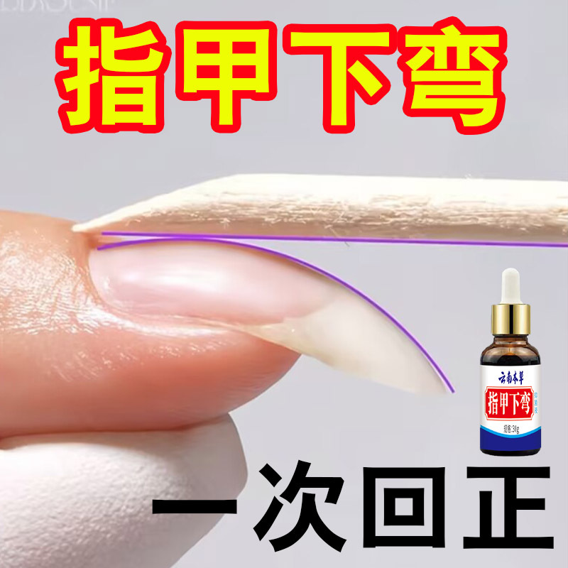 Fingernail Correction Solution for Correcting Ingrown Nails, Repairing Spoon-Shaped Nails, Separating and Cracking Nail Flesh, Vertical Lines, Short and Uneven Nail Beds