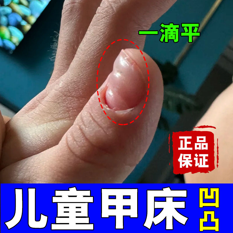 Specializes in Treating Children's Nails That Are Uneven, Hollow, Short, with Short Nail Beds, Thin, Soft, Cracked, with Vertical Lines, and Pure Herbal Repair