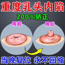 Nipple endosubsidence aligner traction teenage hair stunted to improve maternal lactation breast milk head short recessed suction