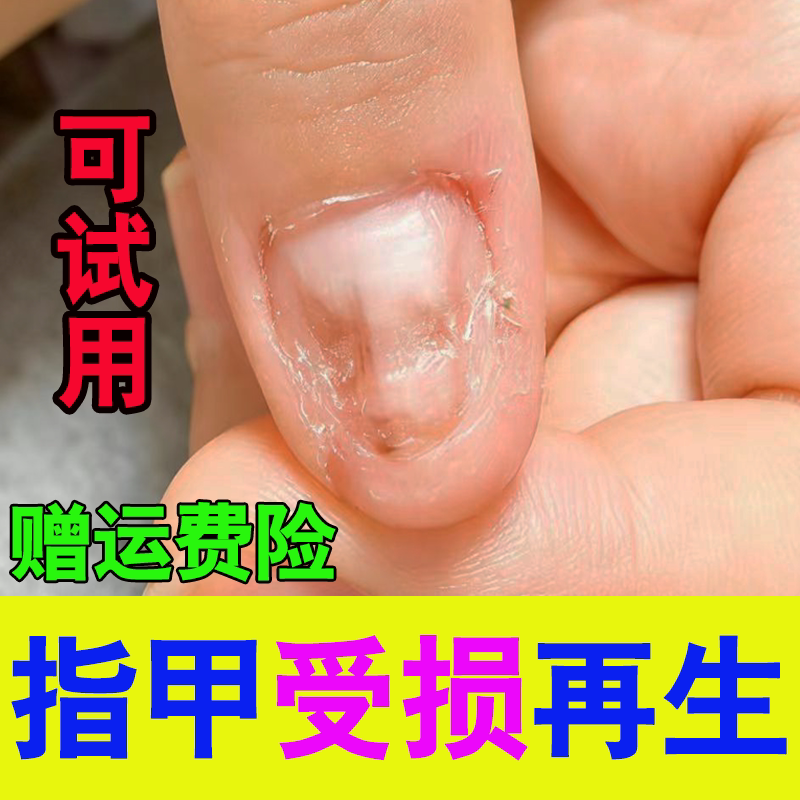 Nail Repair, Damaged Nail Regeneration, Nail Bed Maintenance, Nail Shrinkage, Deformation, Unevenness, and Promotion of Growth