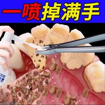 (Dental Recommendation) Tooth stain cleaning tool remove yellowing stones tobacco stains and tea stains unisex tool