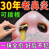 Special medicine for shedding nasal polyps to treat sinusitis turbinate hypertrophy nasal congestion and nasal congestion spray