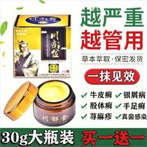 Baicao sweat herpes eczema hand sweat blisters eczema chronic hand finger blisters ointment special for skin