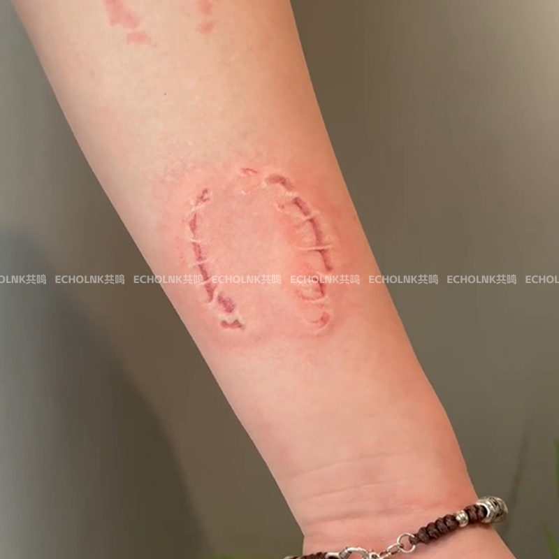 Arm Collarbone Simulated Bite Mark Colorful Tattoo Stickers for Men and Women, Waterproof, Long-Lasting, Pathological Aesthetics, Realistic, Washable Stickers