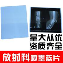X-ray blue-based inkjet medical film DR printing CR dental 8*10 orthopedic radiology dry film A4 roll