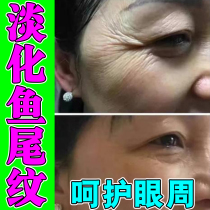 Eye cream to remove crows feet wrinkles around the eyes repair and fade eye lines eye cream to remove fine lines remove eye bags and tighten