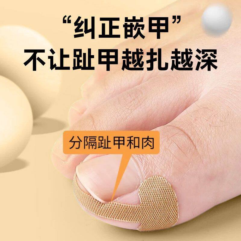 Nail Groove Corrector Device for Ingrown Nails, Specialized Adhesive Patch to Isolate Toenails from Growing into the Flesh, Correct Inflammation, Elastic Bandage