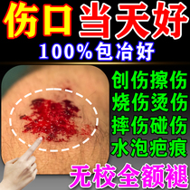 Wound healing promotes muscle growth and muscle growth repair cream that has not healed for a long time removes decay inhibits bacteria and produces muscle old rotten legs burns and scalds