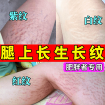 Growth mark repair cream to remove pregnancy and obesity marks scar repair and elimination cream postpartum and pregnancy fade ointment