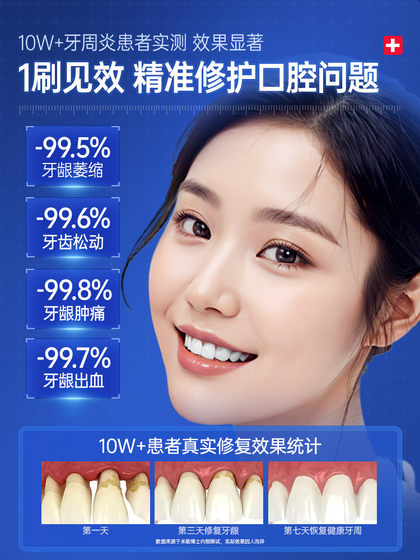 脱敏牙膏治牙周炎口腔牙龈萎缩修复再生抗敏松动固齿脱敏肿痛专用