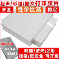 Ultrasound porcelain white inkjet film A4 laser film gastroscopy B-ultrasound four-dimensional color ultrasound film printing paper 100 sheets