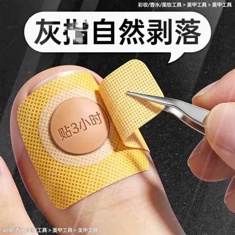 【Hot-Selling Chinese Medicine Product】Specialized Nail Removal Patches with Plant Extracts, Genuine Product, Suitable for Both Toes and Fingernails