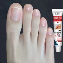 (Quickly remove onychomycosis) Special effect onychomycosis cream antibacterial liquid to repair thick nails layered herbs to remove redness swelling and pain onychomycosis grooves