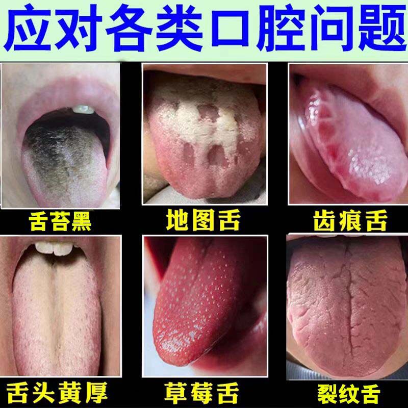 25年必试！舌苔发黑黄厚腻异味？这款草本喷剂真能救急-口鼻清洁杀菌消炎剂-淘宝好物网