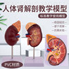 Human Kidney Model, Kidney Anatomy with Adrenal Gland Enlarged Model, Diseased Kidney, Human Internal Organ Anatomy