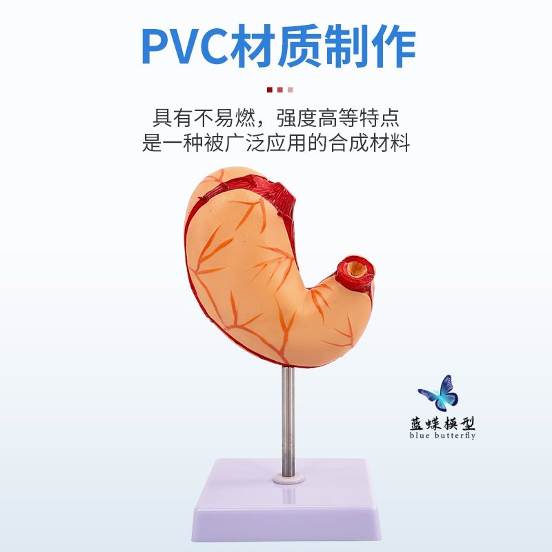Human Stomach Anatomy Model, Stomach Lesion Model, Stomach Disease Demonstration Model, Pathological Stomach, Gastric Perforation