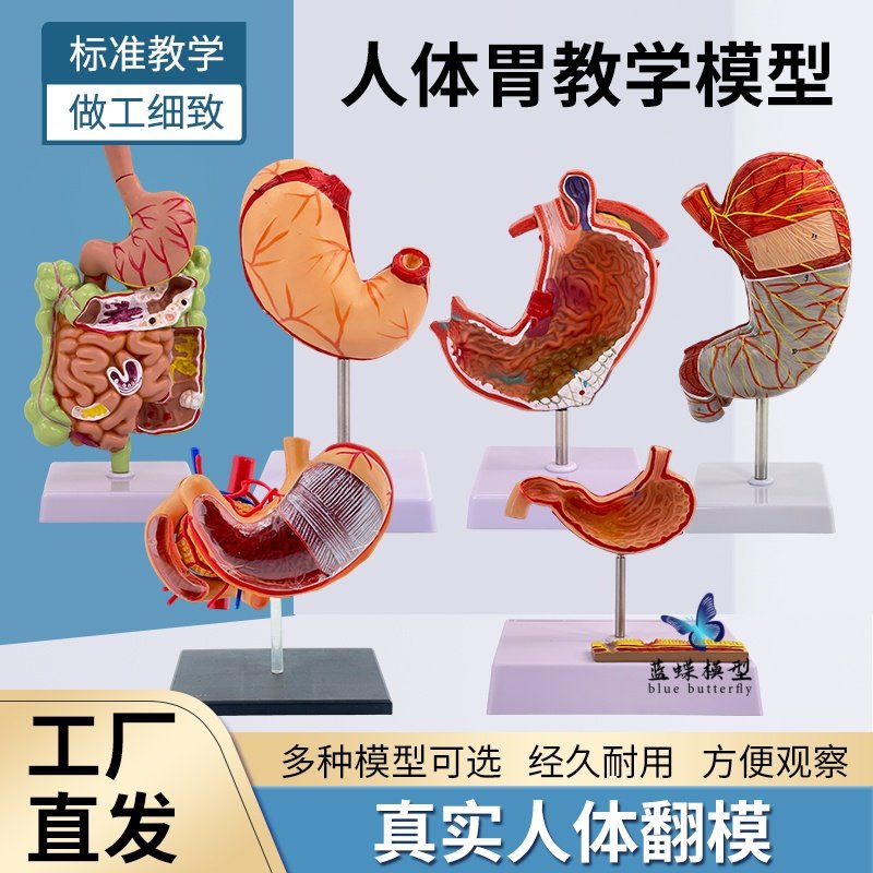 Human Stomach Anatomy Model, Stomach Lesion Model, Stomach Disease Demonstration Model, Pathological Stomach, Gastric Perforation