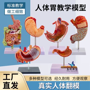 Human Stomach Anatomy Model, Stomach Lesion Model, Stomach Disease Demonstration Model, Pathological Stomach, Gastric Perforation