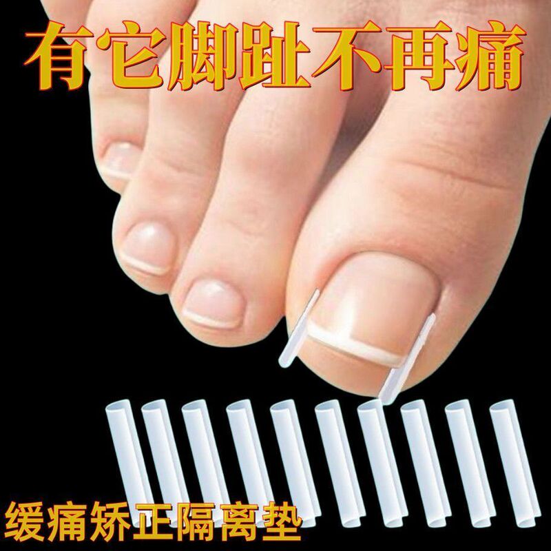 Nail Isolation Pads, Toe Correctors, Toe Pain Relief Pads, Paronychia Correctors, Ingrown Toenail Isolation and Filling Pads