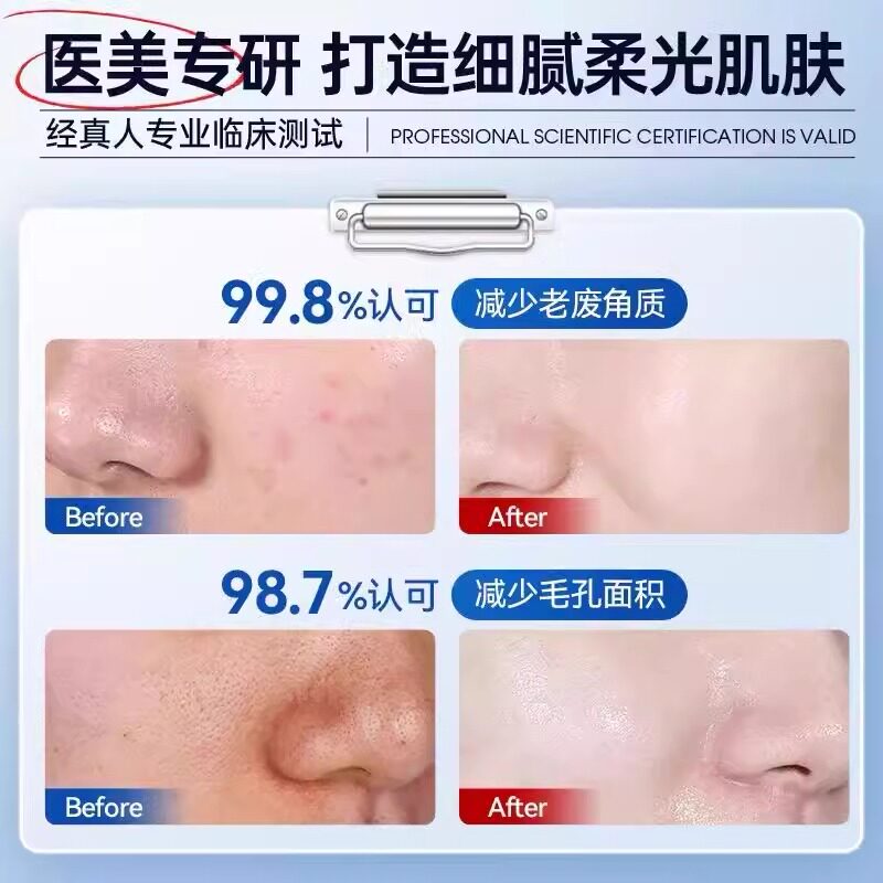 尿素去角质啫喱:告别鸡皮疙瘩,迎接嫩白肌肤🌟-身体磨砂-淘宝百科网