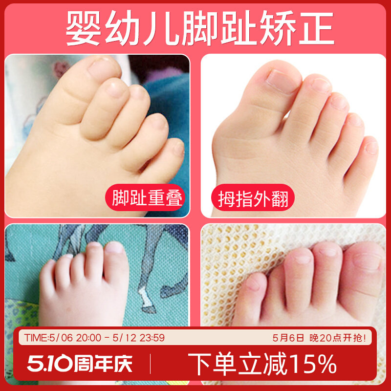 婴儿脚趾矫正器儿童专用宝宝重叠分趾器纠正神器拇指外翻小孩幼儿