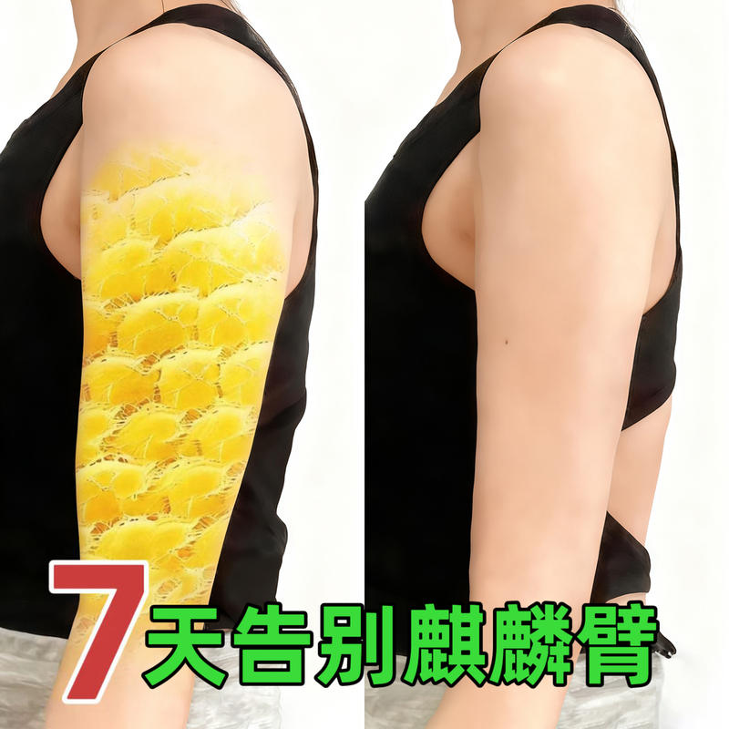 Arm Slimming Tool for Big Arms, Slimming Butterfly Patches to Reduce Flabby Arms, Say Goodbye to "Elephant Trunk" Arms, Goddess Patches