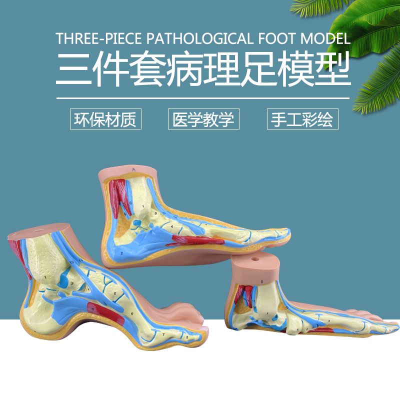 正常足 扁平足 弓型足 模型 足部病理模型人体足部肌肉解剖模型
