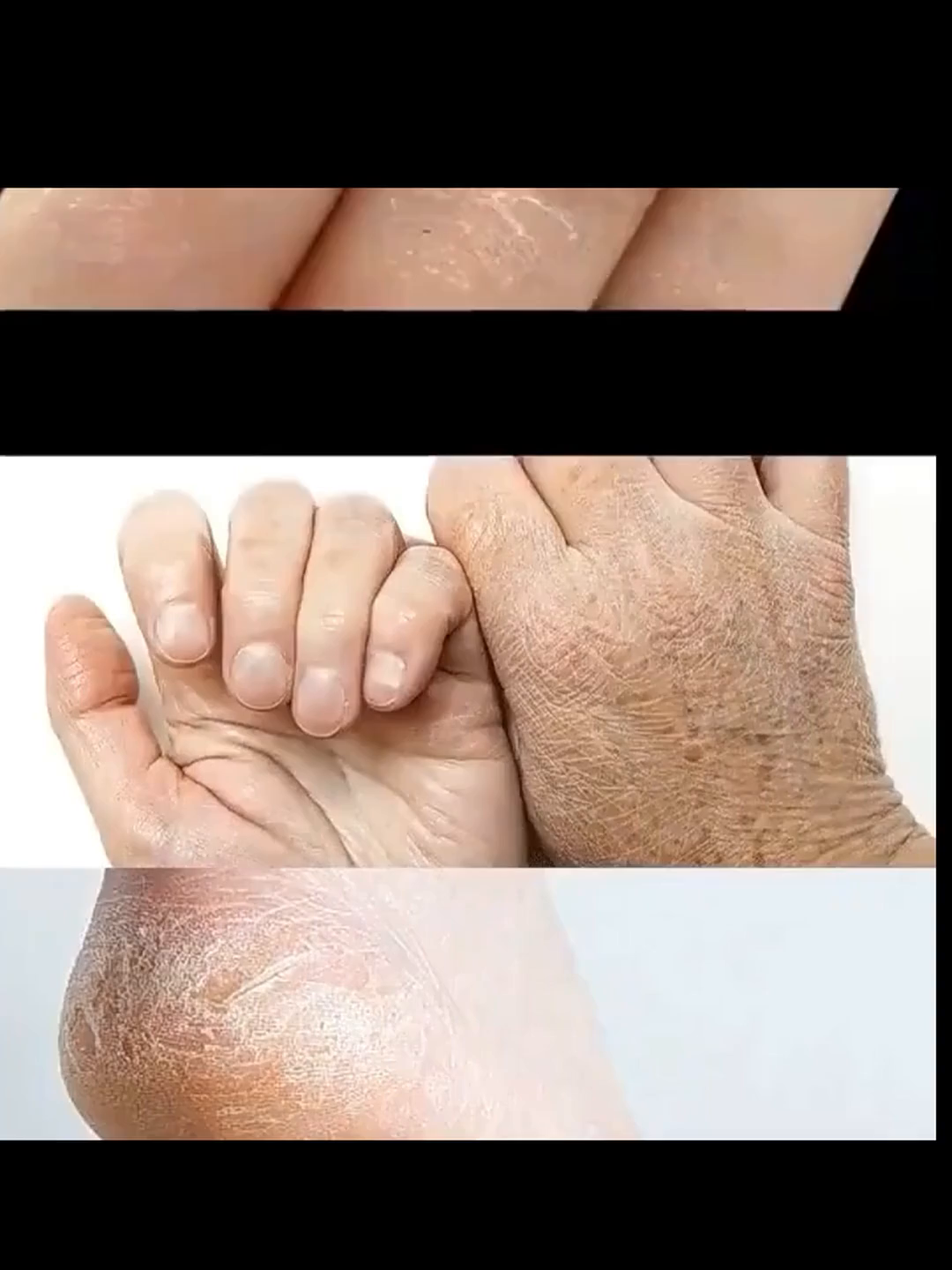 31岁演员孙铱术后报平安，此前查出脑动脉瘤称“是宝宝救了我”_凤凰网, image size:1080x1440