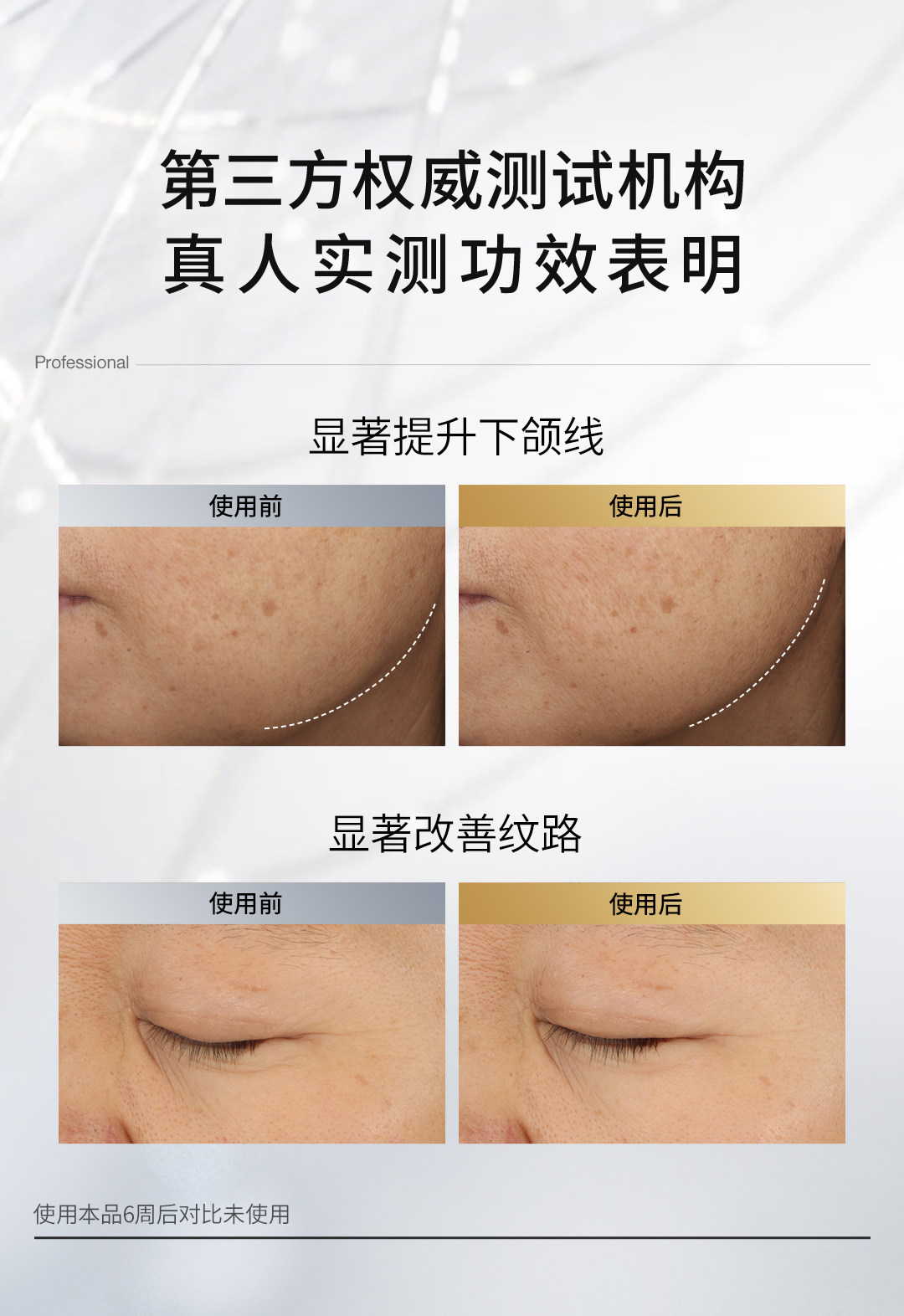 【香港直郵】 韓國 Dr.Jart+ + 蒂佳婷 大白針精華1.5ml×15支 高濃度膠原蛋白勝肽 5重B5 彈潤緊緻 淡紋修護 熬夜肌救星