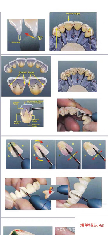 Dental Porcelain, Denture Form Aesthetics, Technical Information, 200g, with Detailed Steps, Great Value for Money