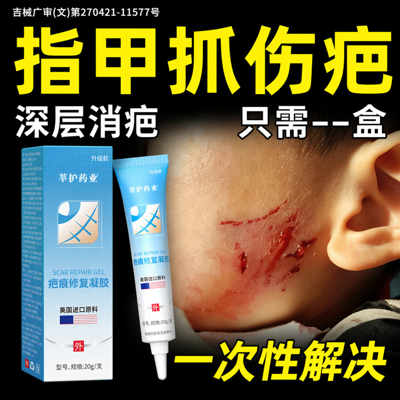 Nail Scratch Scar Removal Cream for Children, Specialized Scar Removal Cream for Children, Medical Repair Gel for Sunken Scars