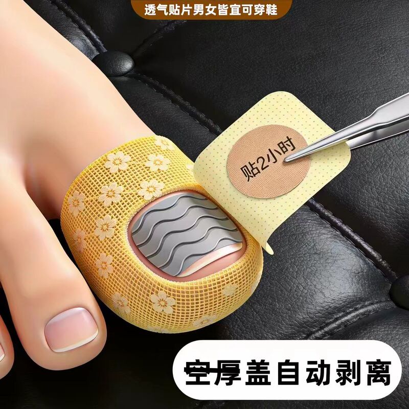 [Hot-Selling Chinese Medicine Product] Herbal Plant Extract Nail Patch, Genuine Product, Specially Designed for Damaged Hands and Feet, Suitable for Both Men and Women