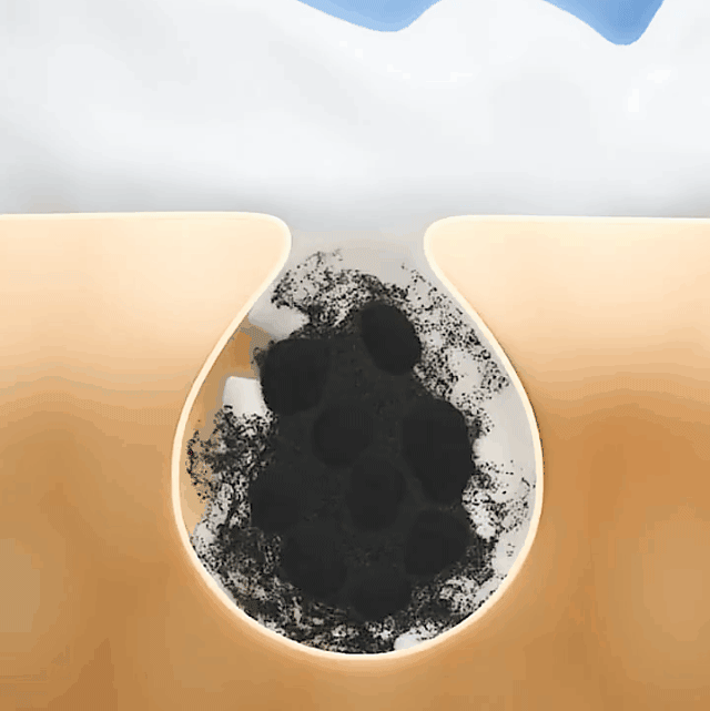 020.gif