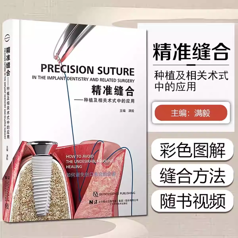 Precision Suturing in the Application of Manyi Implants and Related Procedures (with Surgical Video) Precision Suturing in the Application of Manyi Implants and Related Procedures (with Surgical Video)
